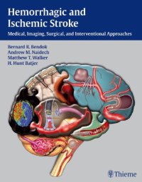 cover of the book Hemorrhagic and Ischemic Stroke: Medical, Imaging, Surgical and Interventional  Approaches