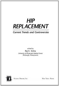 cover of the book Hip replacement : current trends and controversies