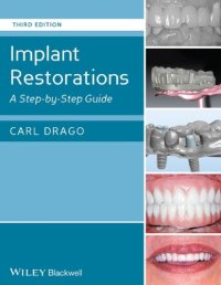 cover of the book Implant restorations : a step by step guide