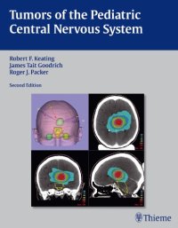 cover of the book Tumors of the Pediatric Central  Nervous System