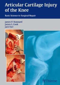 cover of the book Articular cartilage injury of the knee : basic science to surgical repair