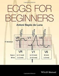 cover of the book ECGs for Beginners