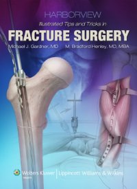 cover of the book Harborview Illustrated Tips and Tricks in Fracture Surgery