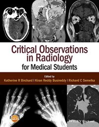 cover of the book Critical Observations in Radiology for Medical Students