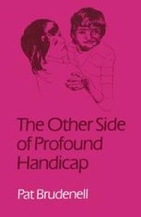 cover of the book The Other Side of Profound Handicap