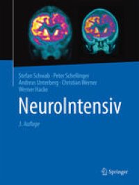 cover of the book NeuroIntensiv