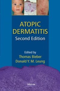 cover of the book Atopic dermatitis