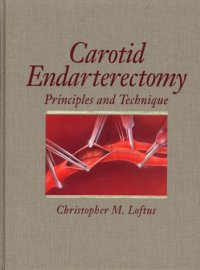 cover of the book Carotid endarterectomy : principles and technique