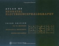 cover of the book Atlas of neonatal electroencephalography