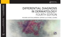 cover of the book Differential Diagnosis in Dermatology