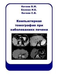 cover of the book Компьютерная томография при заболеваниях печени