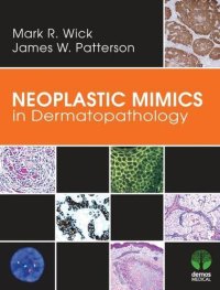 cover of the book Neoplastic Mimics in Dermatopathology