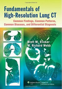 cover of the book Fundamentals of High-Resolution Lung CT: Common Findings, Common Patterns, Common Diseases, and Differential Diagnosis