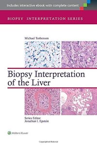 cover of the book Biopsy Interpretation of the Liver