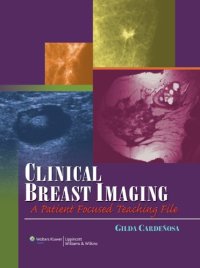 cover of the book Clinical Breast Imaging: A Patient Focused Teaching File