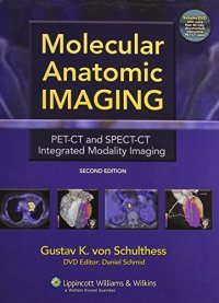 cover of the book Molecular Anatomic Imaging: PET-CT and SPECT-CT Integrated Modality Imaging