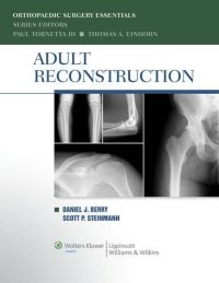 cover of the book Adult Reconstruction