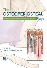 cover of the book The Osteoperiosteal Flap: A Simplified Approach to Alveolar Bone Reconstruction