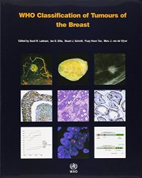 cover of the book WHO Classification of Tumours of the Breast