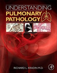 cover of the book Understanding Pulmonary Pathology. Applying Pathological Findings in Therapeutic Decision Making