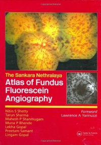 cover of the book Atlas of Fundus Fluorescein Angiography