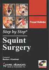 cover of the book Squint surgery