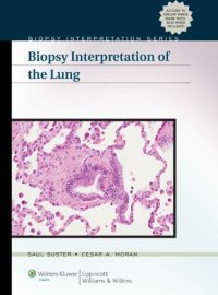 cover of the book Biopsy Interpretation of the Lung