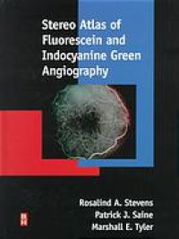 cover of the book Stereo atlas of fluorescein and indocyanine green angiography