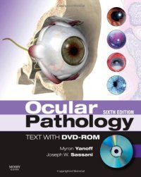 cover of the book Ocular Pathology