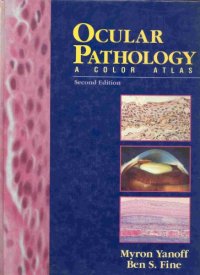 cover of the book Ocular pathology : a color atlas