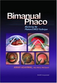 cover of the book Bimanual Phaco: Mastering the Phakonit/MICS Technique