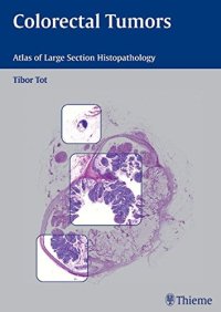 cover of the book Colorectal tumors: atlas of large section histopathology