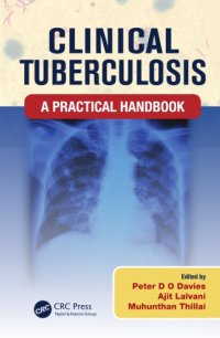 cover of the book Clinical tuberculosis: a practical handbook