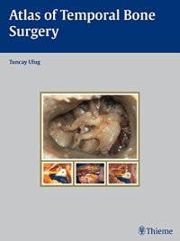 cover of the book Atlas of temporal bone surgery