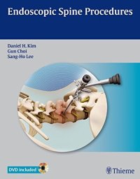 cover of the book Endoscopic spine procedures