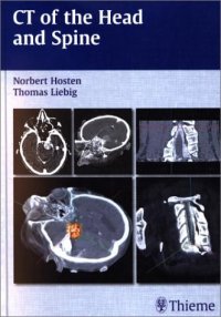 cover of the book CT of the head and spine