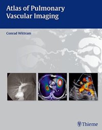 cover of the book Atlas of pulmonary vascular imaging