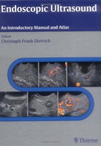 cover of the book Endoscopic ultrasound: an introductory manual and atlas ; 94 tables