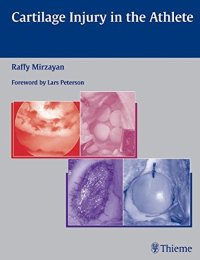 cover of the book Cartilage injury in the athlete