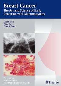 cover of the book Breast cancer: the art and science of early detection with mammography: perception, interpretation, histopathologic correlation