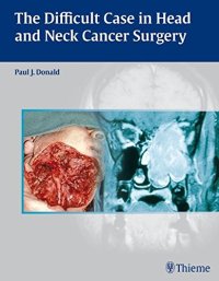 cover of the book The difficult case in head and neck cancer surgery