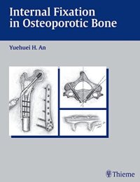 cover of the book Internal fixation in osteoporotic bone