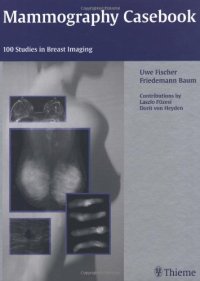 cover of the book Mammography casebook: 100 studies in breast imaging ; 168 tables