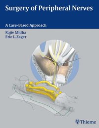 cover of the book Surgery of peripheral nerves