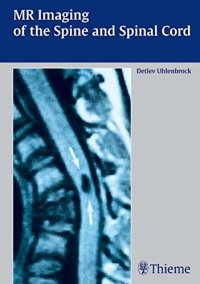 cover of the book MR imaging of the spine and the spinal cord