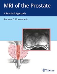 cover of the book MRI of the prostate: a practical approach