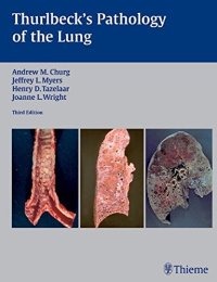 cover of the book Thurlbeck’s pathology of the lung