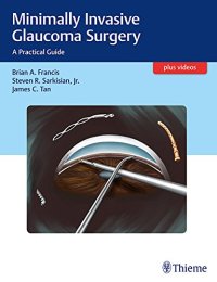 cover of the book Minimally invasive glaucoma surgery: a practical guide