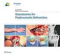 cover of the book Osteotomies for posttraumatic deformities