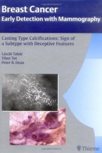 cover of the book Casting Type Calcifications Sign of a Subtype with Deceptive Features